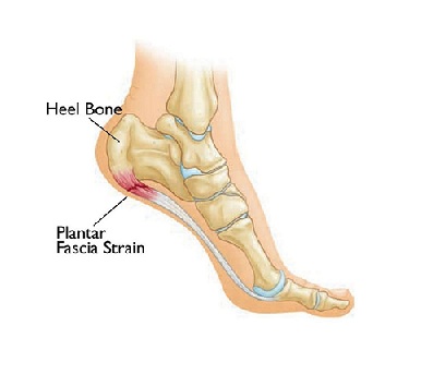 plantar.jpg